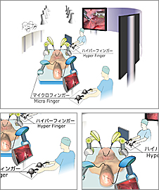 医療・福祉ロボット 遠隔微細手術用ロボットの画像